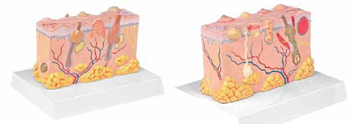 Pathological Model of the Skin